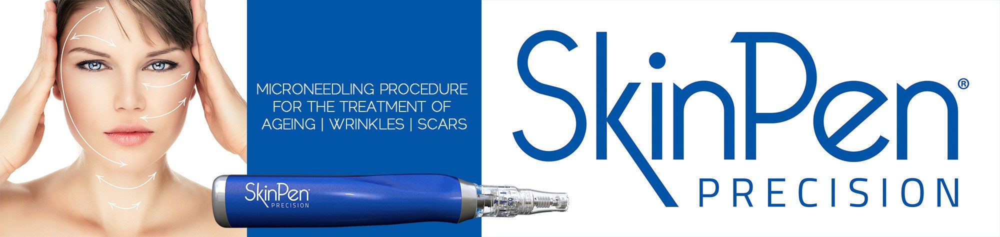 Skin Pen Treatments